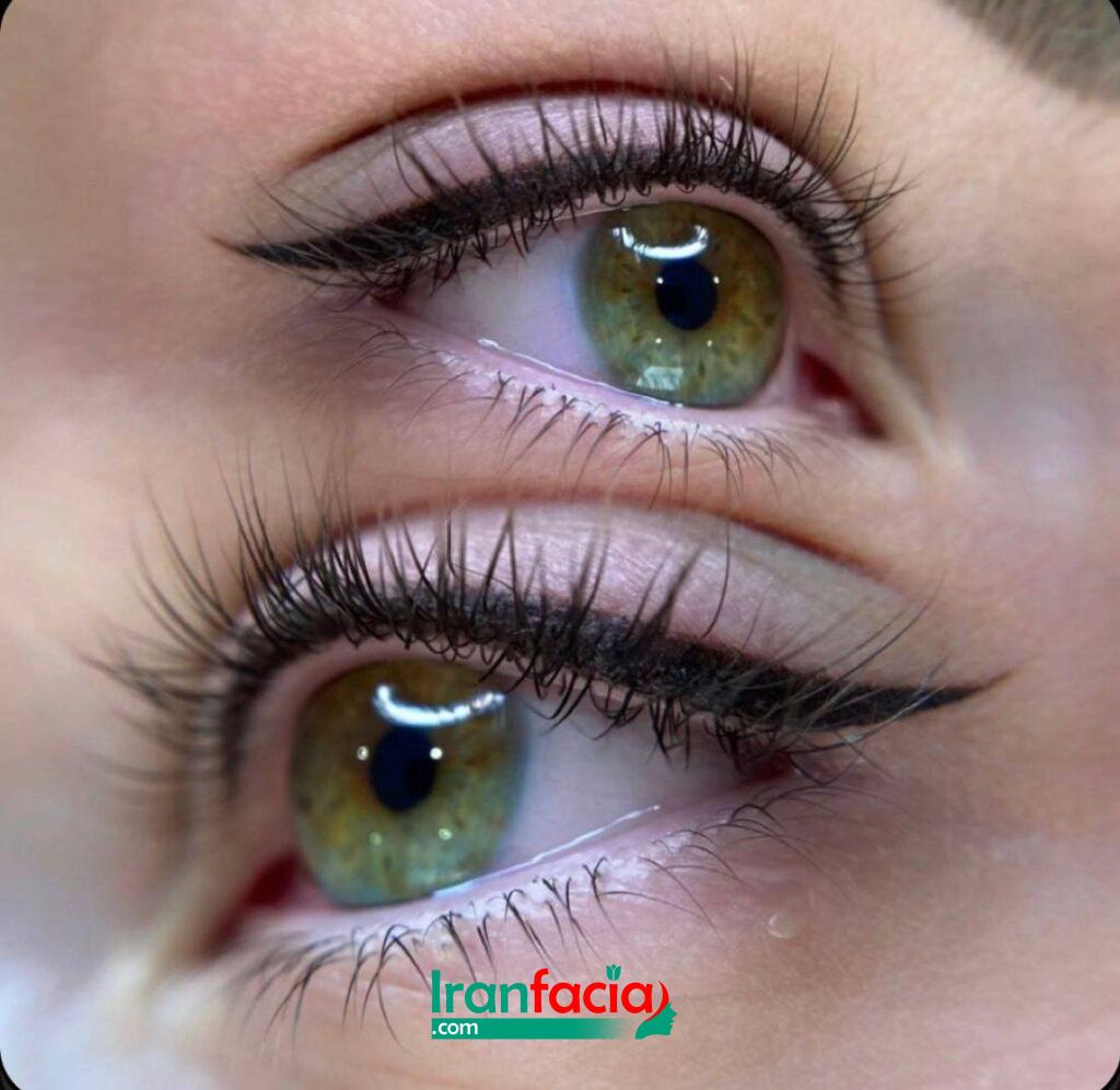 بهترین خدمات میکروبلیدینگ در چهارباغ | بهترین مرکز فیبروز در چهارباغ