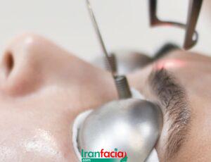 بهترین خدمات تتو ریمووال در غرب تهران | مرکز ریموو تاتو در غرب تهران