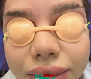 بهترین خدمات تتو ریمووال در شمال تهران | مرکز ریموو تاتو در شمال تهران